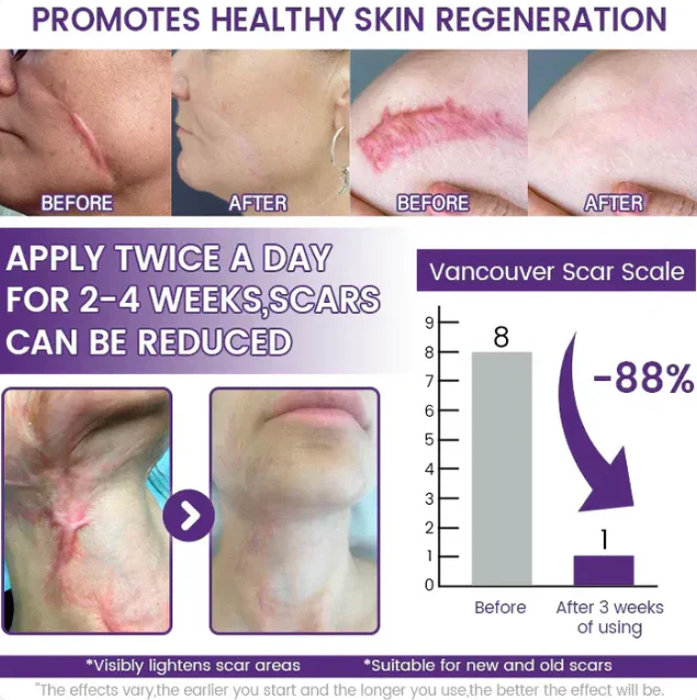ReGenScar Stem Cell Repair Gel (Visible Scar Improvement in 7 Days) - Image 3