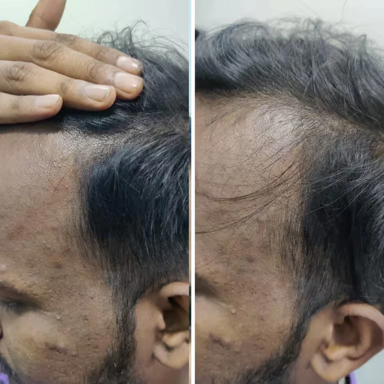 Rosemary Advanced Hair Growth Serum for Pattern Baldness | Promotes New Hair Growth - Image 10