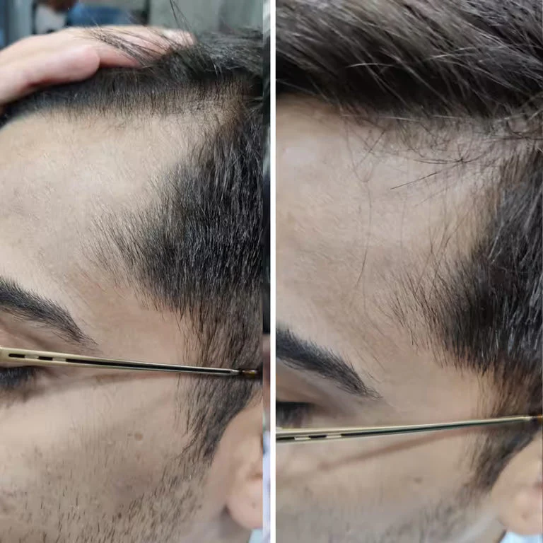 Rosemary Advanced Hair Growth Serum for Pattern Baldness | Promotes New Hair Growth - Image 11