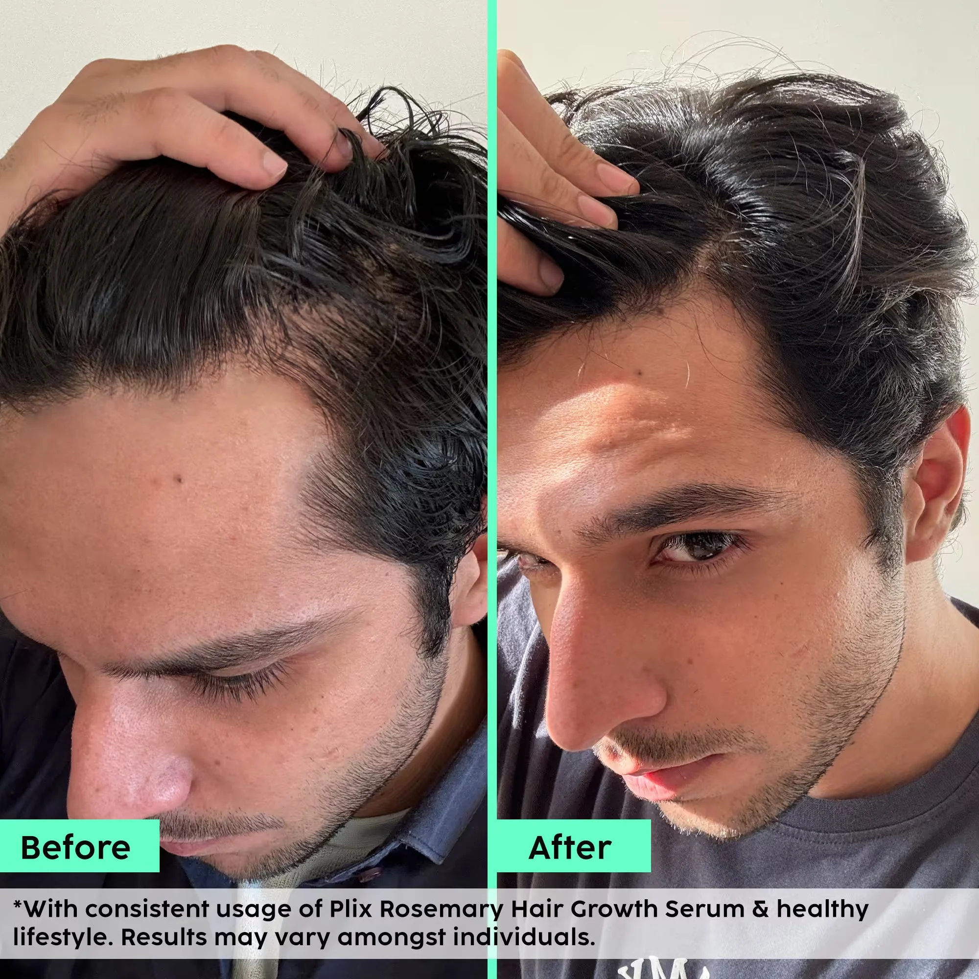 Rosemary Advanced Hair Growth Serum for Pattern Baldness | Promotes New Hair Growth - Image 3