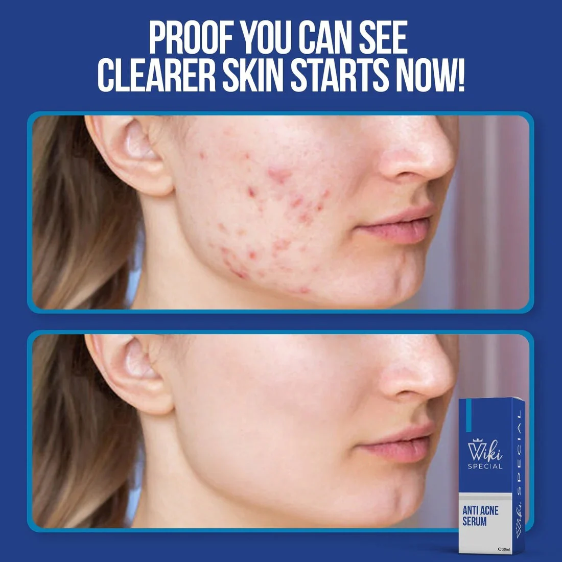 Wiki Special Serum - Image 2